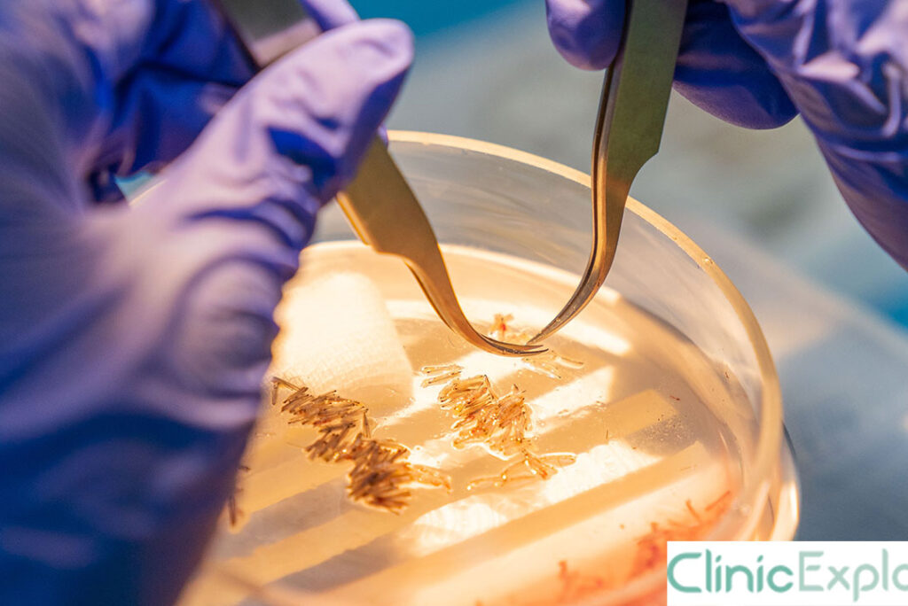 Izmir FUT – Follicular Unit Transplantation