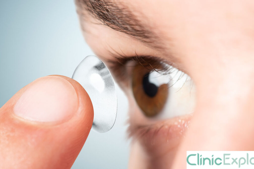 Izmir Intraocular Lenses