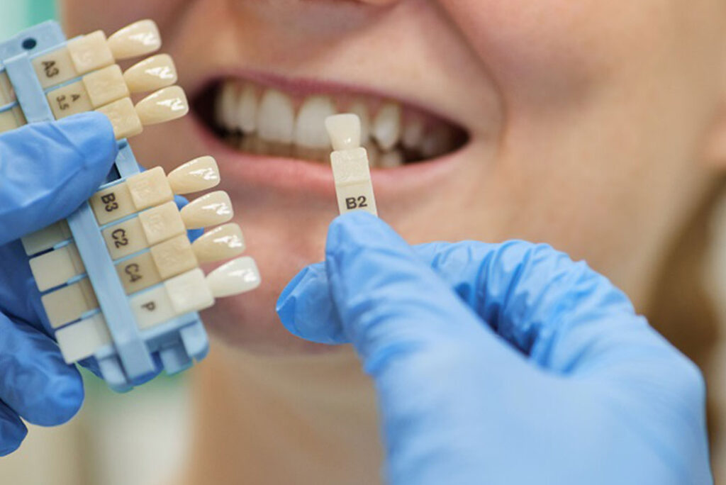 Izmir Dental implants