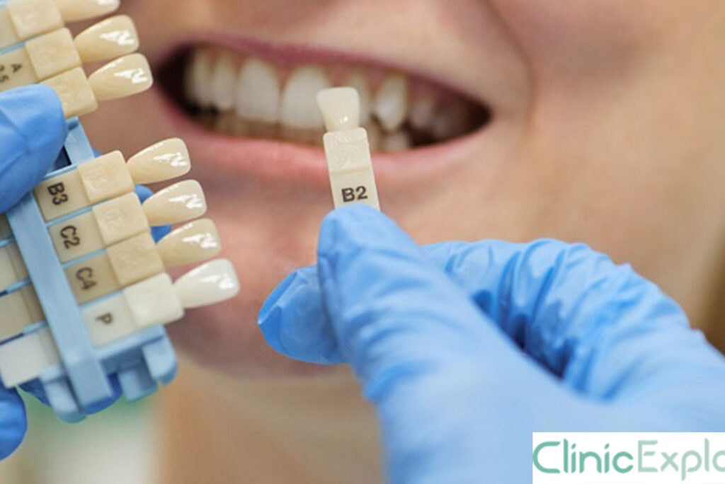 Izmir Dental Implants