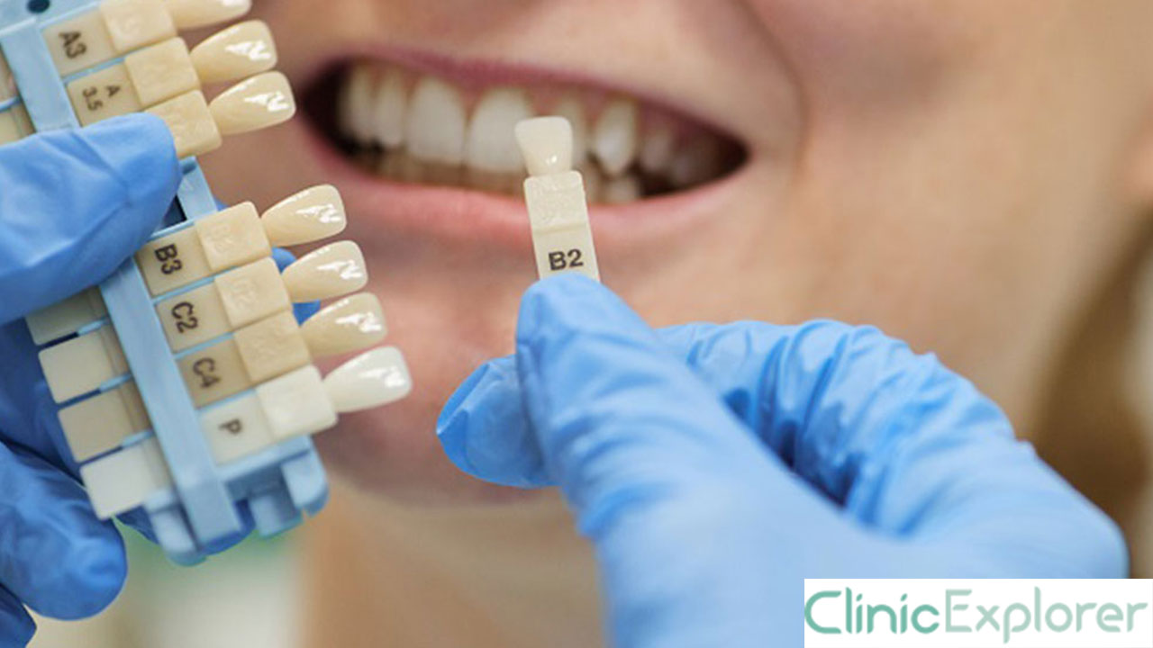 Izmir Dental Implants